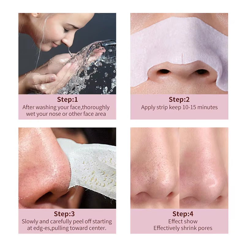 10-100Pcs Nose Blackhead Remover Mask Deep Cleansing Skin Care Shrink Pore Acne Treatment Mask Nose Black Dots Pore Clean Strips