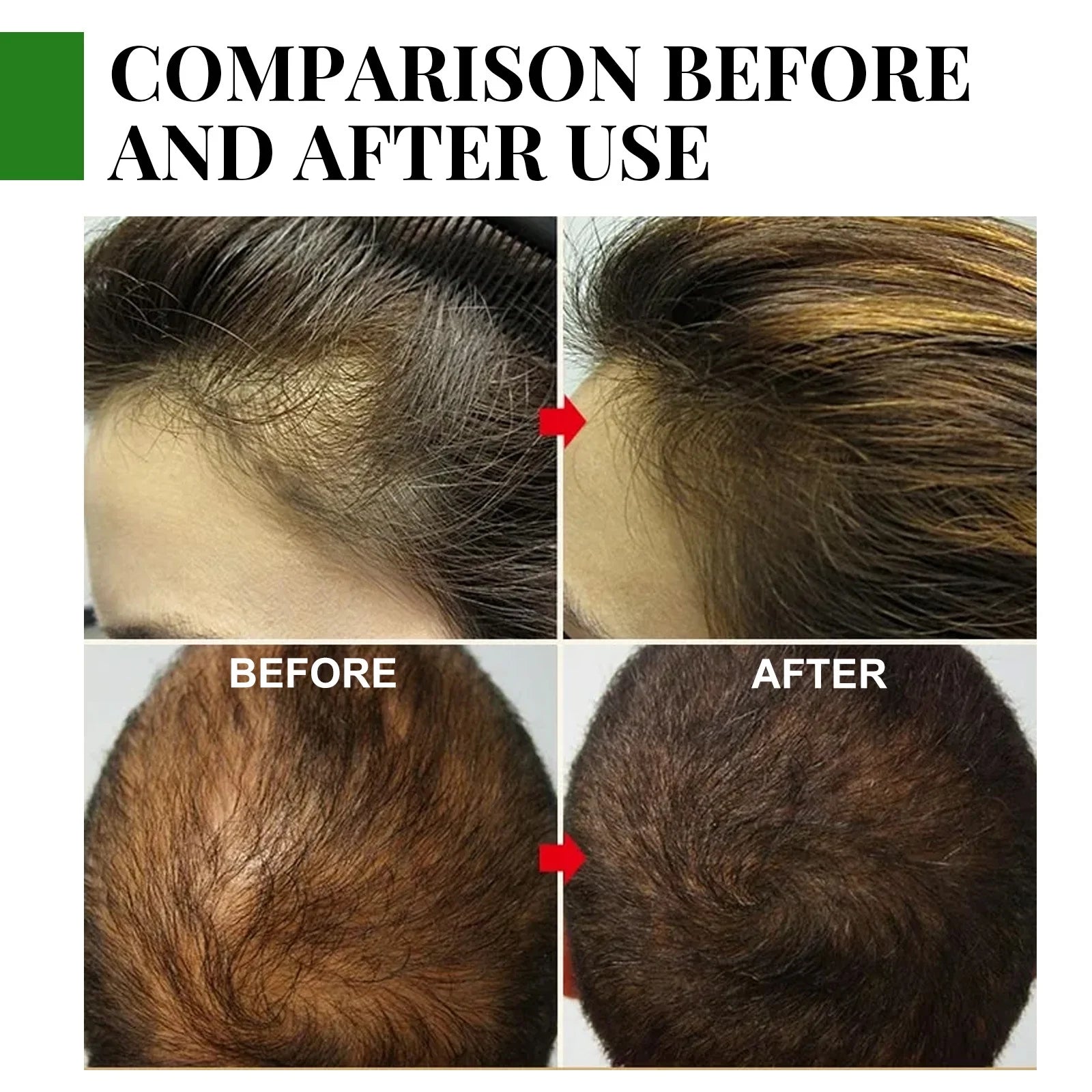 2 Pack Rosemary Oil for Hair Growth & Skin Care,Organic Rosemary , Natural Rosemary Oil for Hair Loss Treatment, Stimulates Hair Growth, Scalp Massager
