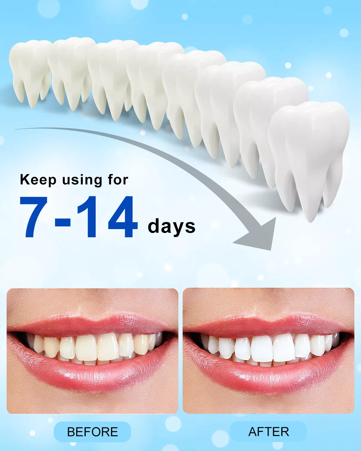 5-LED Teeth Whitening Light with Teeth Whitening Tray Teeth Whitener